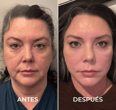 Brosse Lymphatique pour Visage